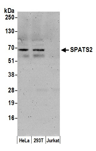 SPATS2/SPATA10 Antibody in Western Blot (WB)