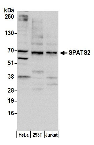 SPATS2/SPATA10 Antibody in Western Blot (WB)