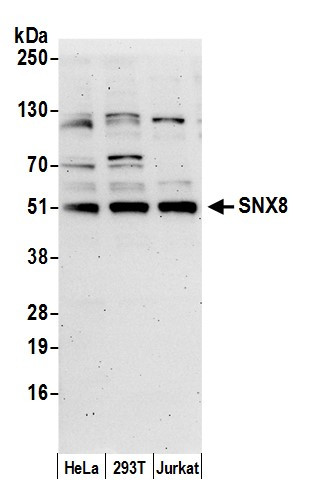 SNX8 Antibody in Western Blot (WB)
