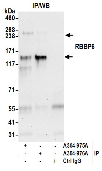 RBBP6 Antibody in Immunoprecipitation (IP)