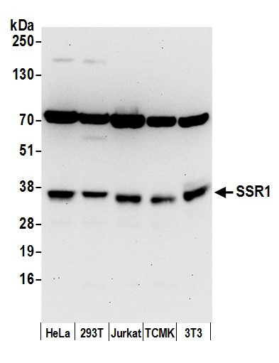 SSR1/TRAP alpha Antibody in Western Blot (WB)