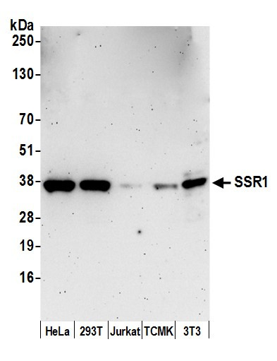 SSR1/TRAP alpha Antibody in Western Blot (WB)