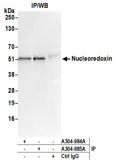 Nucleoredoxin/NXN Antibody in Immunoprecipitation (IP)