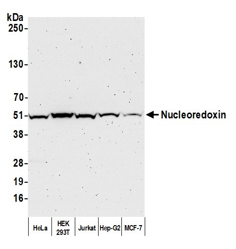 Nucleoredoxin/NXN Antibody in Western Blot (WB)