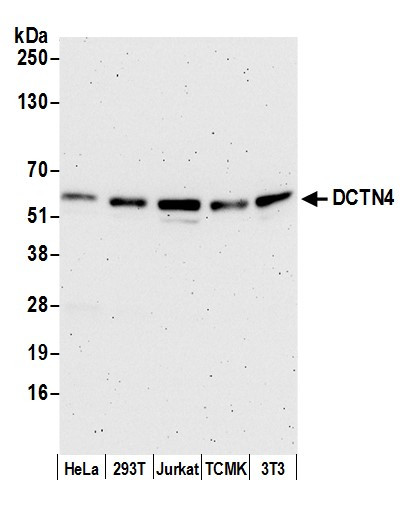 DCTN4/Dynactin p62 Antibody in Western Blot (WB)