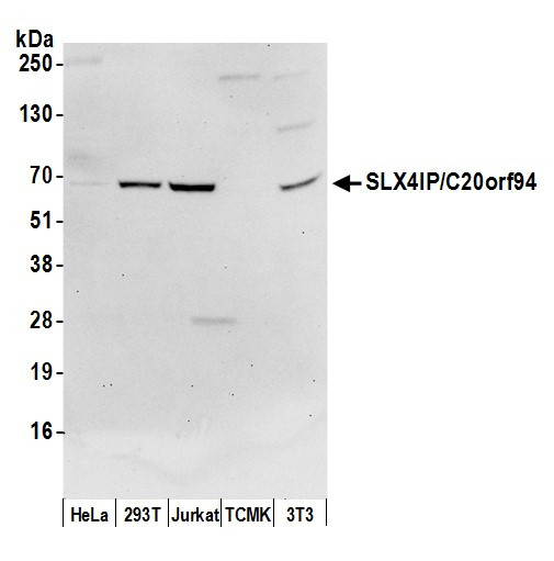 SLX4IP/C20orf94 Antibody in Western Blot (WB)