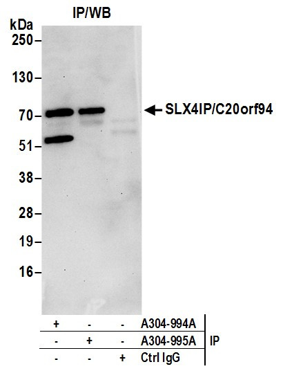 SLX4IP/C20orf94 Antibody in Immunoprecipitation (IP)