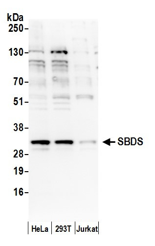 Shwachman-Bodian-Diamond Syndrome/SBDS Antibody in Western Blot (WB)