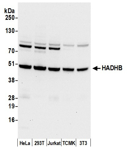 HADHB Antibody in Western Blot (WB)