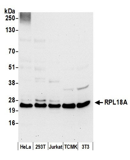 RPL18A/Ribosomal Protein L18a Antibody in Western Blot (WB)