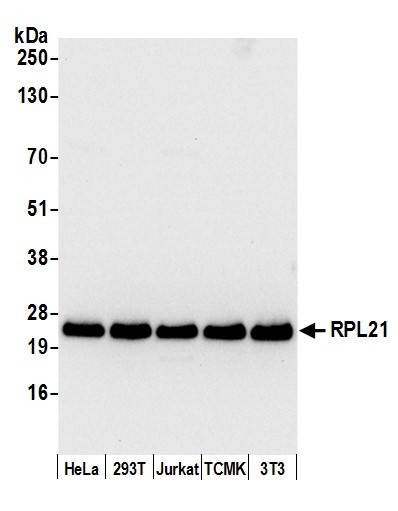 RPL21/Ribosomal Protein L21 Antibody in Western Blot (WB)