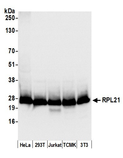 RPL21/Ribosomal Protein L21 Antibody in Western Blot (WB)