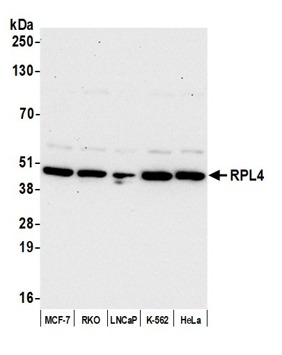 RPL4/Ribosomal Protein L4 Antibody in Western Blot (WB)