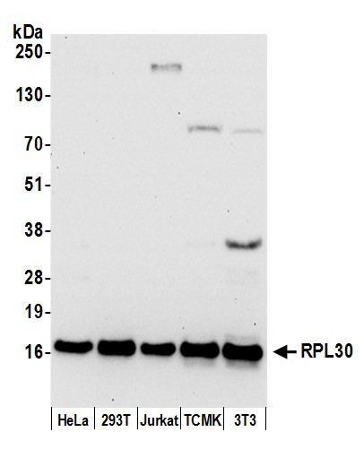 RPL30/Ribosomal Protein L30 Antibody in Western Blot (WB)