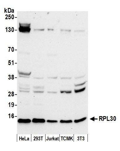 RPL30/Ribosomal Protein L30 Antibody in Western Blot (WB)