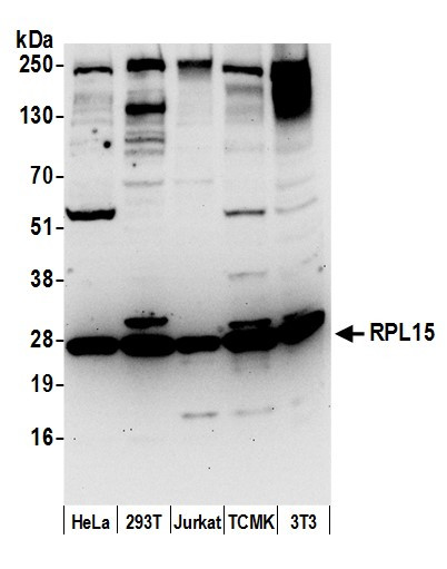 RPL15/Ribosomal Protein L15 Antibody in Western Blot (WB)