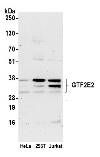 GTF2E2/TF2E2/TFIIE-beta Antibody in Western Blot (WB)
