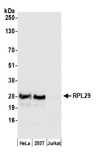 RPL29/Ribosomal Protein L29 Antibody in Western Blot (WB)