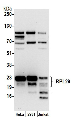 RPL29/Ribosomal Protein L29 Antibody in Western Blot (WB)