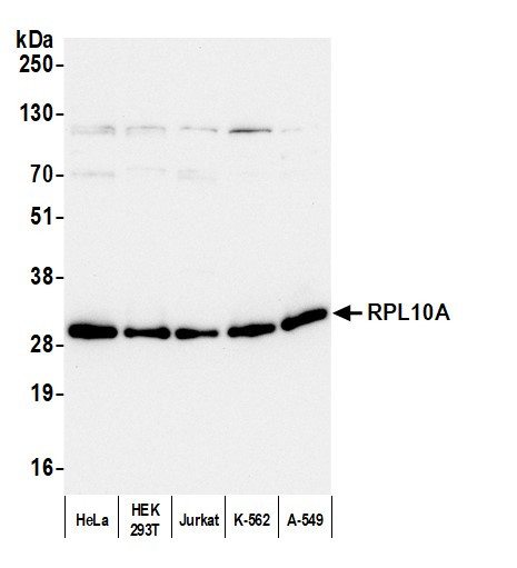 RPL10A/Ribosomal Protein L10a Antibody in Western Blot (WB)