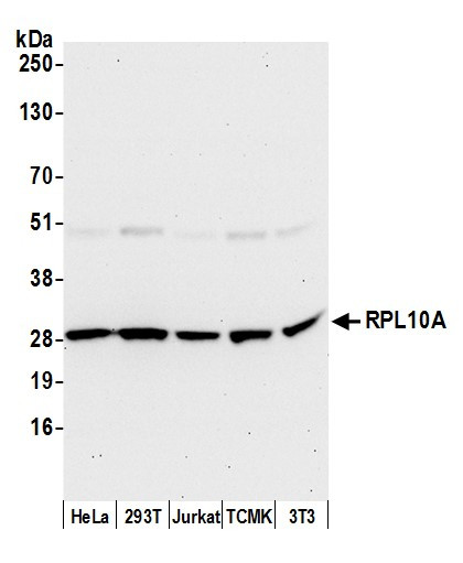 RPL10A/Ribosomal Protein L10a Antibody in Western Blot (WB)