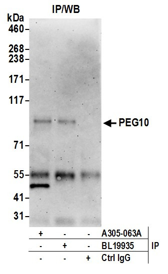 PEG10 Antibody in Immunoprecipitation (IP)