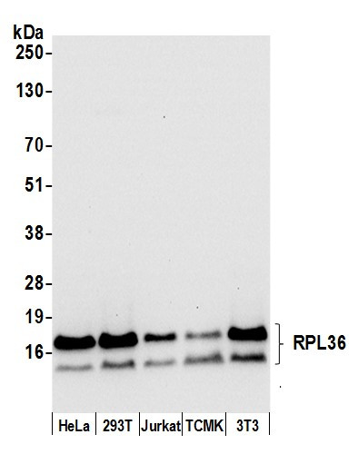 RPL36/Ribosomal Protein L36 Antibody in Western Blot (WB)