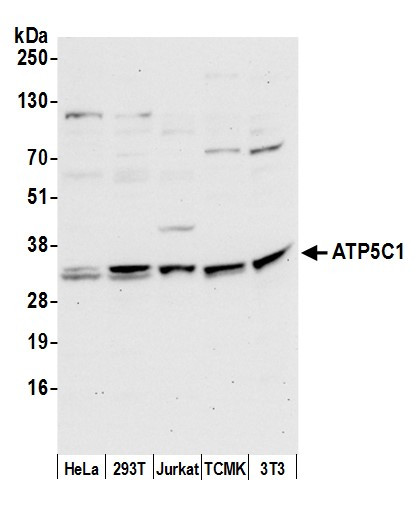 ATP5C1/ATPG Antibody in Western Blot (WB)