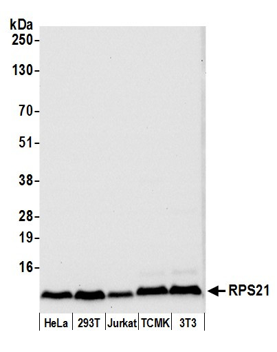 RPS21/Ribosomal Protein S21 Antibody in Western Blot (WB)