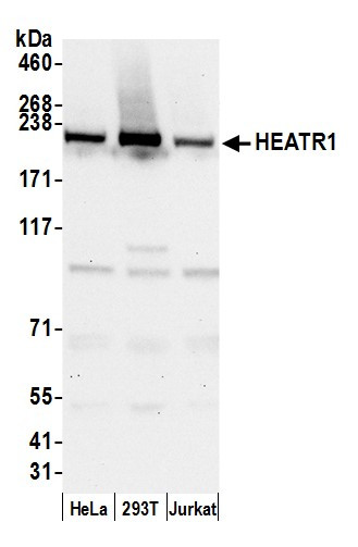 HEATR1/BAP28 Antibody in Western Blot (WB)
