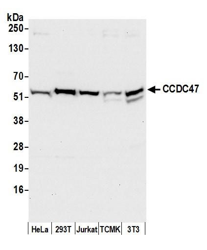 CCDC47 Antibody in Western Blot (WB)
