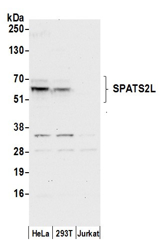 SPATS2L Antibody in Western Blot (WB)