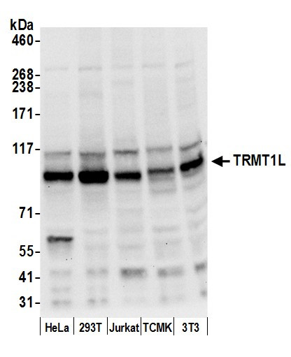 TRMT1L/C1orf25 Antibody in Western Blot (WB)