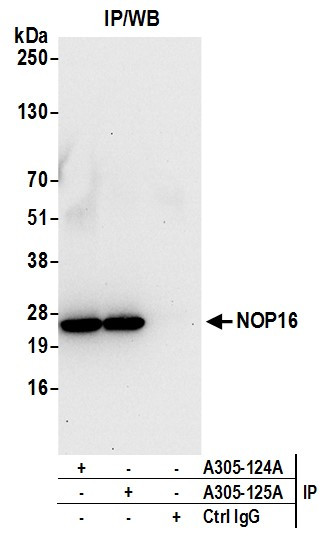 NOP16/HSPC111 Antibody in Immunoprecipitation (IP)