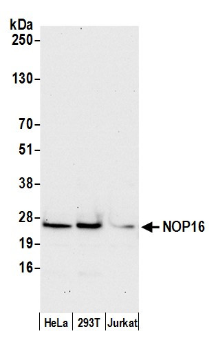 NOP16/HSPC111 Antibody in Western Blot (WB)