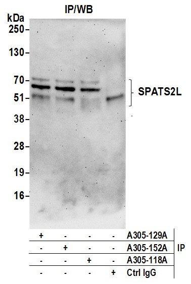 SPATS2L Antibody in Immunoprecipitation (IP)