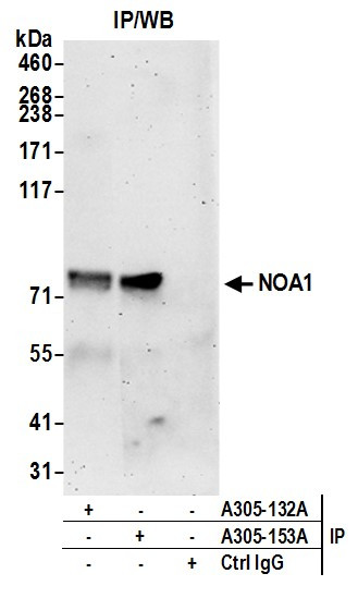 NOA1/C4orf14 Antibody in Immunoprecipitation (IP)