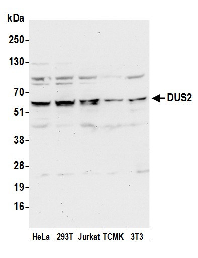 DUS2/DUS2L Antibody in Western Blot (WB)