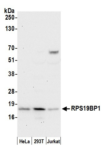 RPS19BP1/AROS Antibody in Western Blot (WB)
