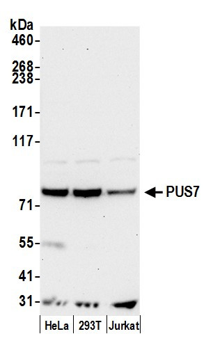 PUS7 Antibody in Western Blot (WB)