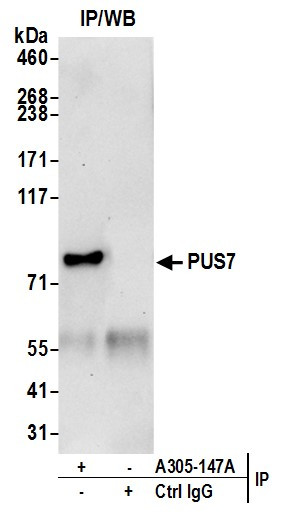PUS7 Antibody in Immunoprecipitation (IP)