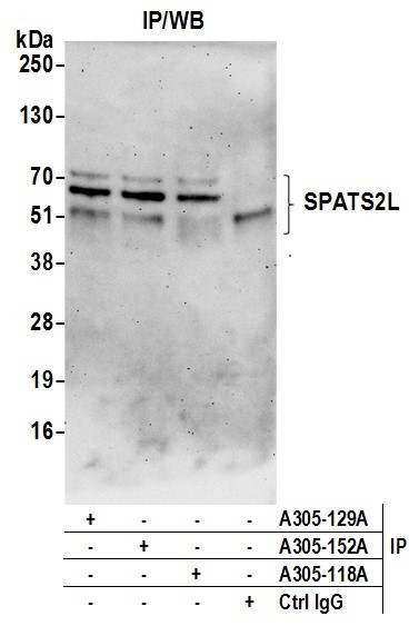 SPATS2L Antibody in Immunoprecipitation (IP)