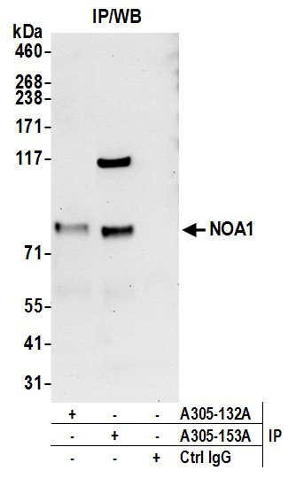 NOA1/C4orf14 Antibody in Immunoprecipitation (IP)