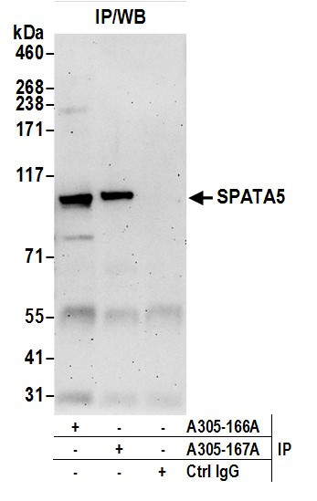 SPATA5 Antibody in Immunoprecipitation (IP)