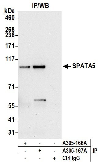 SPATA5 Antibody in Immunoprecipitation (IP)