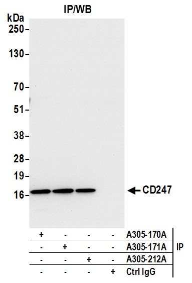 CD247/CD3Z Antibody in Immunoprecipitation (IP)