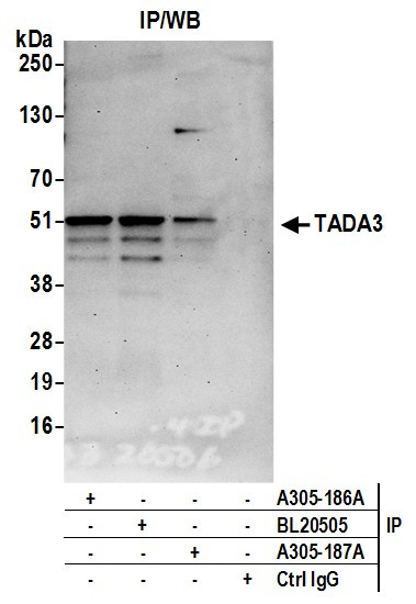 TADA3/TADA3L Antibody in Immunoprecipitation (IP)