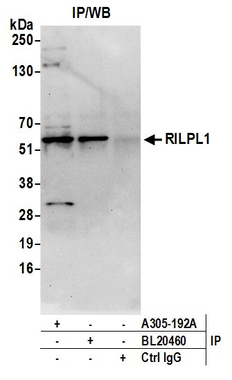RILPL1 Antibody in Immunoprecipitation (IP)