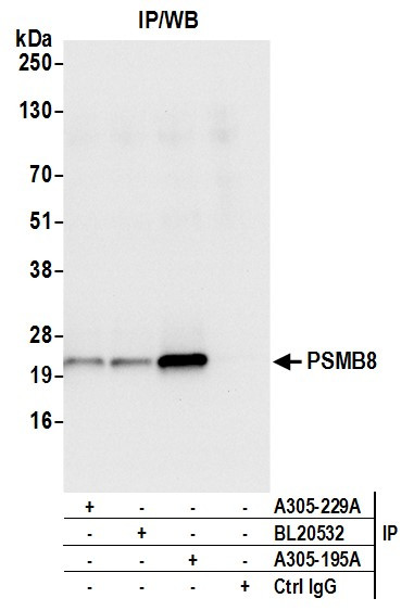 PSMB8/LMP7 Antibody in Immunoprecipitation (IP)