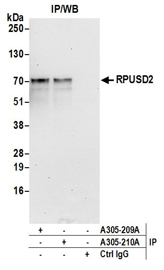 RPUSD2 Antibody in Immunoprecipitation (IP)